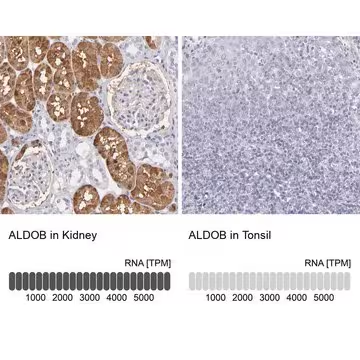 Anti-ALDOB antibody produced in rabbit, 1 X 100 µL (HPA002198-100UL)