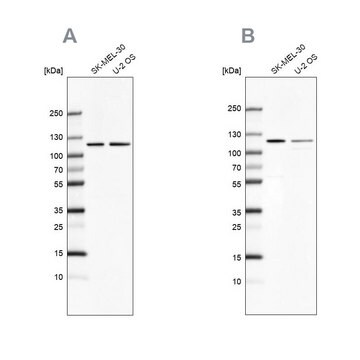 Anti-LONP1 antibody produced in rabbit, 1 X 100 µL (HPA002034-100UL)