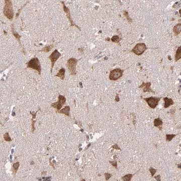 Anti-USP51 antibody produced in rabbit, 1 X 100 µL (HPA001942-100UL)