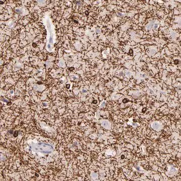 Anti-ZC3H7B antibody produced in rabbit, 1 X 100 µL (HPA001784-100UL)