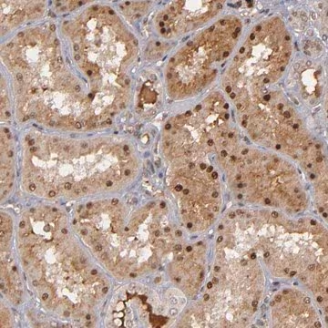 Anti-ZNF234 antibody produced in rabbit, 1 X 100 µL (HPA001664-100UL)