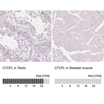 Anti-CTCFL antibody produced in rabbit, 1 X 100 µL (HPA001472-100UL)
