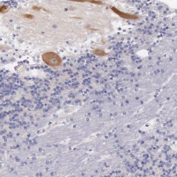 Anti-LRFN5 antibody produced in rabbit, 1 X 100 µL (HPA001177-100UL)