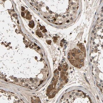 Anti-VCPKMT antibody produced in rabbit, 1 X 100 µL (HPA001146-100UL)