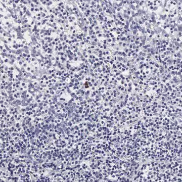 Anti-RNASE6 antibody produced in rabbit, 1 X 100 µL (HPA000698-100UL)