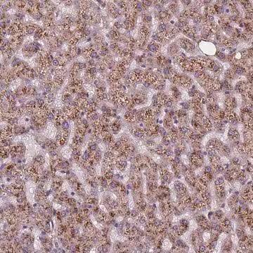 Anti-AMMECR1 antibody produced in rabbit, 100 µL (HPA000590-100UL)