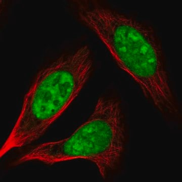Anti-AK6 antibody produced in rabbit, 100 µL (HPA034935-100UL)