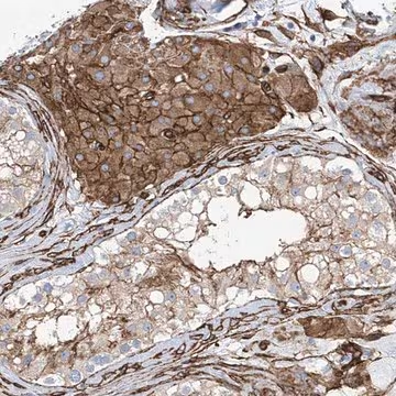 Anti-UBTD1 antibody produced in rabbit, 1 X 100 µL (HPA034825-100UL)