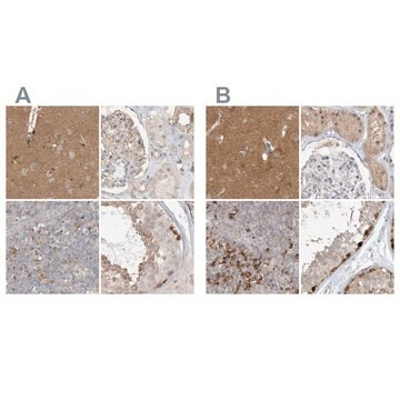 Anti-RNF219 antibody produced in rabbit, 1 X 100 µL (HPA034785-100UL)