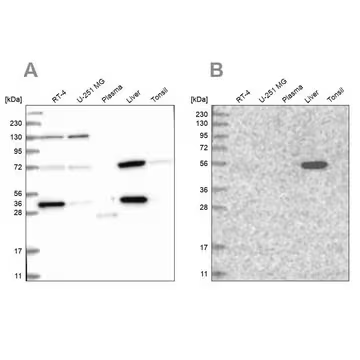 Anti-UGP2 antibody produced in rabbit, 100 µL (HPA034697-100UL)