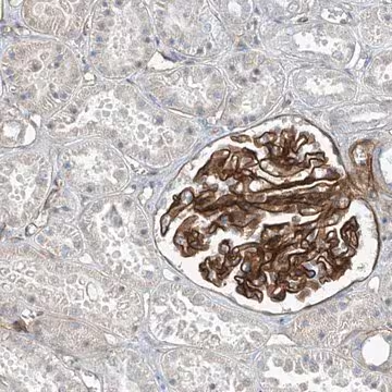 Anti-TNS2 antibody produced in rabbit, 1 X 100 µL (HPA034659-100UL)