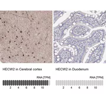 Anti-HECW2 antibody produced in rabbit, 1 X 100 µL (HPA034609-100UL)