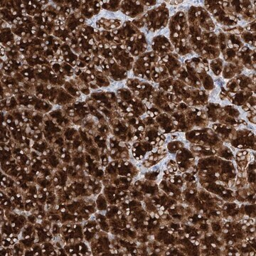 Anti-PPEF1 antibody produced in rabbit, 1 X 100 µL (HPA034577-100UL)