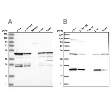 Anti-PPP1R7 antibody produced in rabbit, 100 µL (HPA034500-100UL)