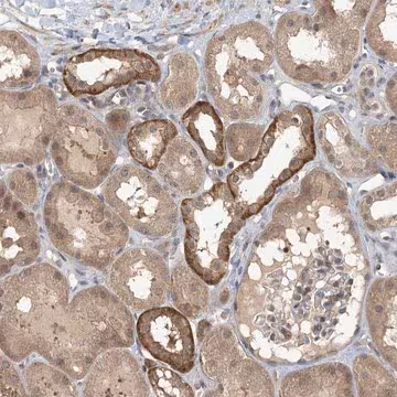 Anti-ZC3H12A antibody produced in rabbit, 1 X 100 µL (HPA032052-100UL)