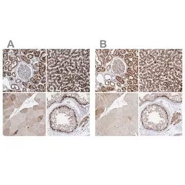 Anti-ABCD3 antibody produced in rabbit, 1 X 100 µL (HPA032027-100UL)