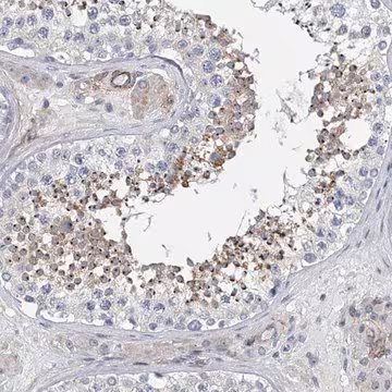 Anti-ALG14 antibody produced in rabbit, 1 X 100 µL (HPA031829-100UL)