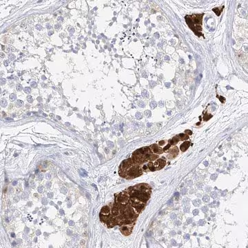 Anti-ZZEF1 antibody produced in rabbit, 1 X 100 µL (HPA031778-100UL)