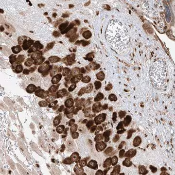 Anti-ZBTB8A antibody produced in rabbit, 1 X 100 µL (HPA031768-100UL)