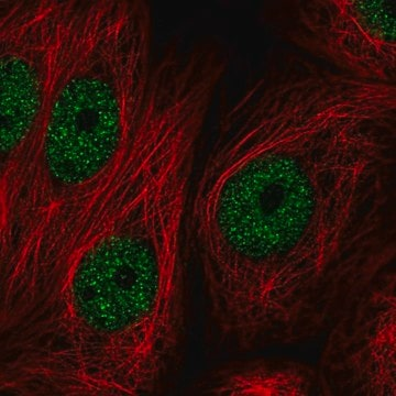 Anti-ZBTB21 antibody produced in rabbit, 100 µL (HPA031758-100UL)