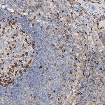 Anti-PHACTR2 antibody produced in rabbit, 1 X 100 µL (HPA031725-100UL)