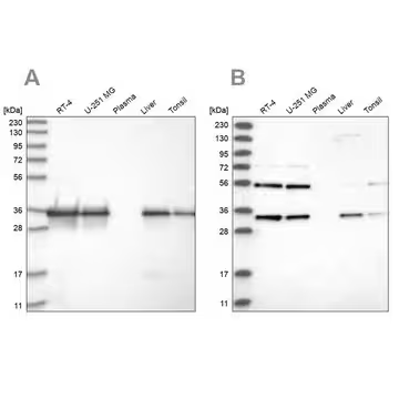 Anti-PPA2 antibody produced in rabbit, 1 X 100 µL (HPA031671-100UL)