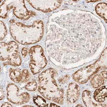 Anti-MIPEP antibody produced in rabbit, 1 X 100 µL (HPA031670-100UL)