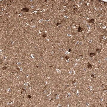 Anti-GHDC antibody produced in rabbit, 1 X 100 µL (HPA031650-100UL)