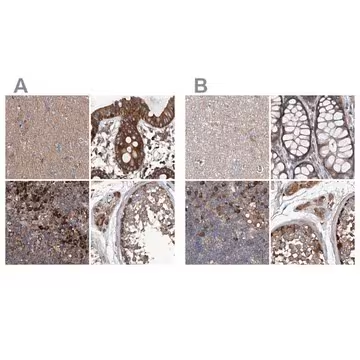 Anti-ASCC3 antibody produced in rabbit, 1 X 100 µL (HPA031610-100UL)