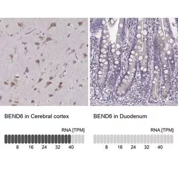 Anti-BEND6 antibody produced in rabbit, 1 X 100 µL (HPA031605-100UL)