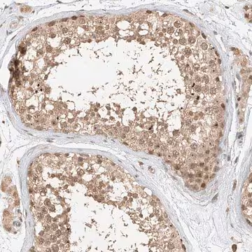 Anti-CXorf58 antibody produced in rabbit, 1 X 100 µL (HPA031542-100UL)