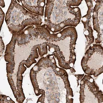 Anti-MTUS2 antibody produced in rabbit, 1 X 100 µL (HPA031475-100UL)