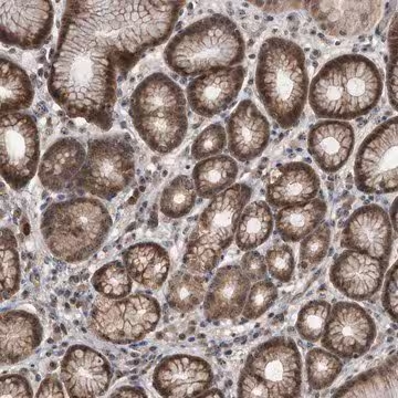 Anti-PELO antibody produced in rabbit, 1 X 100 µL (HPA031458-100UL)