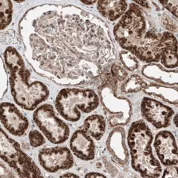 Anti-ZNF620 antibody produced in rabbit, 1 X 100 µL (HPA031452-100UL)