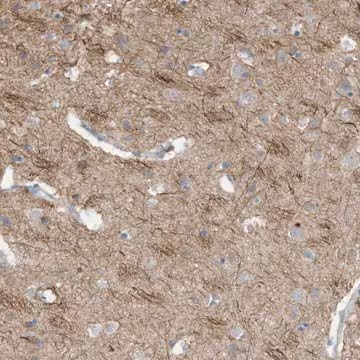 Anti-GTPBP2 antibody produced in rabbit, 1 X 100 µL (HPA031419-100UL)