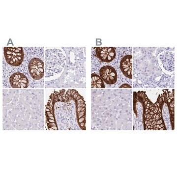 Anti-LGALS4 antibody produced in rabbit, 100 µL (HPA031185-100UL)