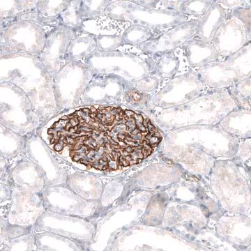 Anti-SYNPO antibody produced in rabbit, 1 X 100 µL (HPA034631-100UL)