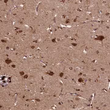 Anti-SLC11A2 antibody produced in rabbit, 1 X 100 µL (HPA032140-100UL)