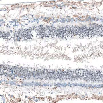 Anti-FAM161A antibody produced in rabbit, 1 X 100 µL (HPA032119-100UL)