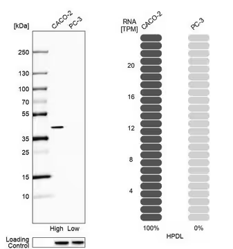 Anti-HPDL antibody produced in rabbit, 1 X 100 µL (HPA031997-100UL)