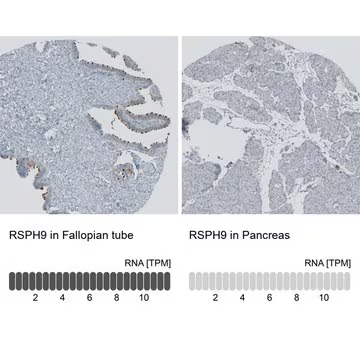 Anti-RSPH9 antibody produced in rabbit, 1 X 100 µL (HPA031703-100UL)
