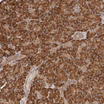 Anti-RPS6 antibody produced in rabbit, 1 X 100 µL (HPA031153-100UL)