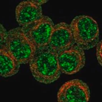 Anti-EPOR antibody produced in rabbit, 1 X 100 µL (HPA077654-100UL)