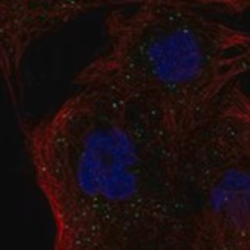 Anti-HLA-DMB antibody produced in rabbit, 1 X 100 µL (HPA077524-100UL)