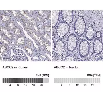 Anti-ABCC2 antibody produced in rabbit, 1 X 100 µL (HPA071145-100UL)
