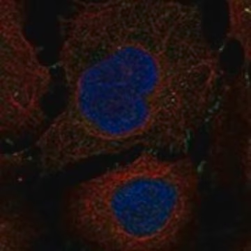 Anti-IL13RA2 antibody produced in rabbit, 1 X 100 µL (HPA067363-100UL)