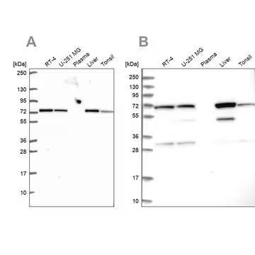 Anti-SDHA antibody produced in rabbit, 100 µL (HPA064582-100UL)