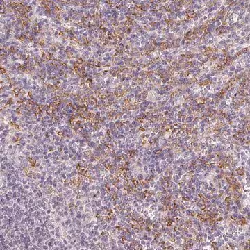 Anti-IFNGR1 antibody produced in rabbit, 100 µL (HPA063871-100UL)