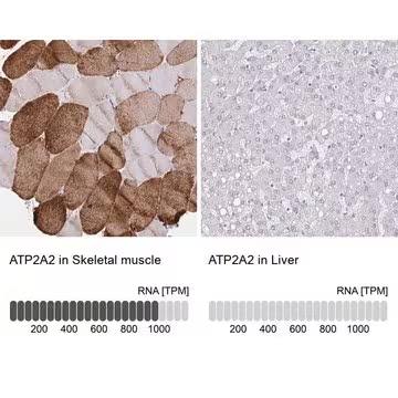 Anti-ATP2A2 antibody produced in rabbit, 1 X 100 µL (HPA062605-100UL)