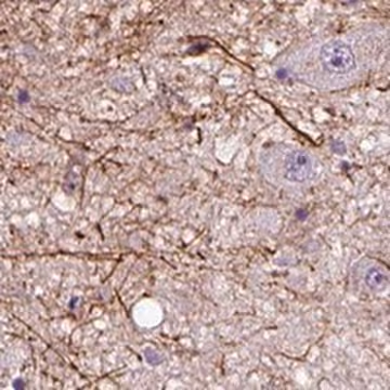 Anti-ADRB3 antibody produced in rabbit, 100 µL (HPA061969-100UL)